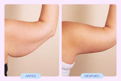 CREMA ESCULPIDORA Y TONIFICANTE DE BRAZOS | GOPURE