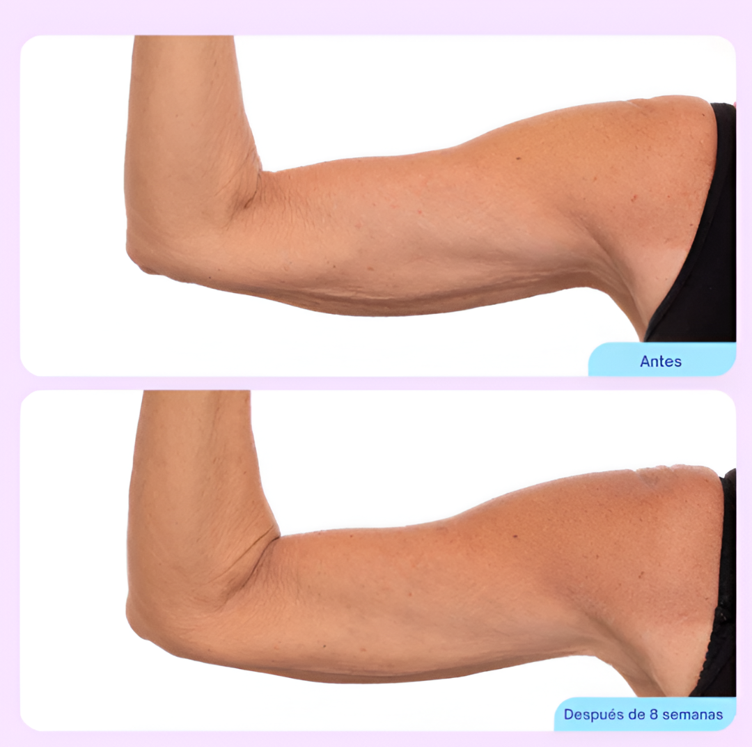 CREMA ESCULPIDORA Y TONIFICANTE DE BRAZOS | GOPURE